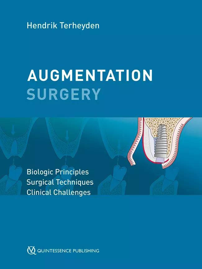 Augmentation Surgery Biologic Principles | Surgical Techniques | Clinical Challenges - Pdf